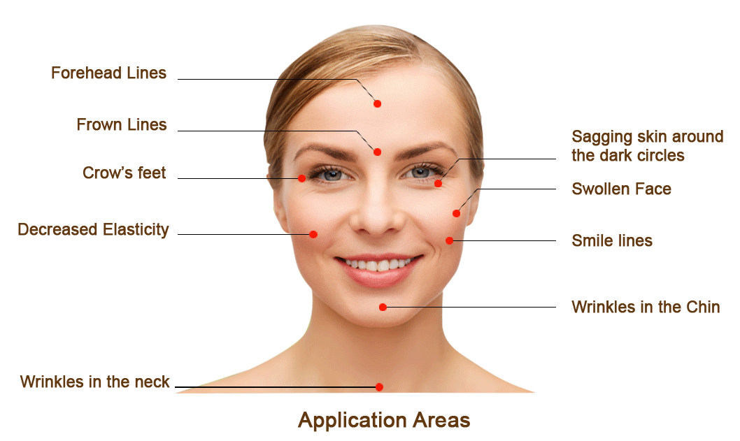 Cosmetic Acupuncture